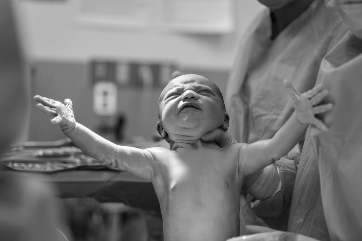 How to Follow Up on Your Birth Injury Case